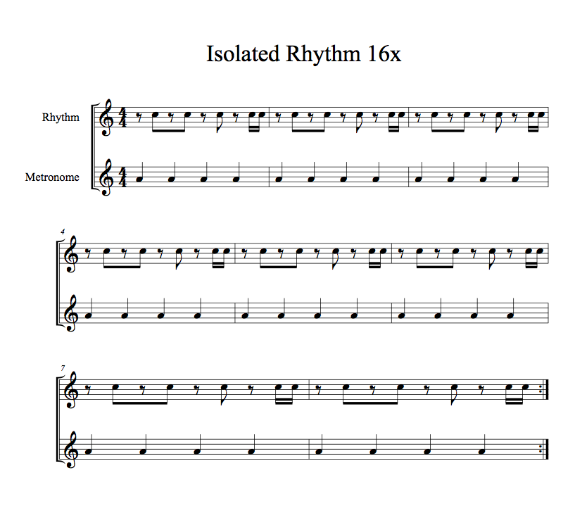 Isolated Rhythm